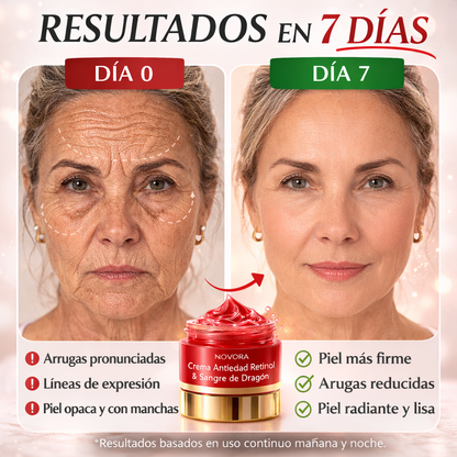 Crema Antiarrugas con Retinol y Sangre de Dragón | Reafirma y Rejuvenece tu Piel en Días